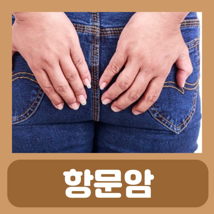  항문암 증상 원인 : 아랫배 항문 안쪽 통증 농양 출혈 따가움 부음 질환