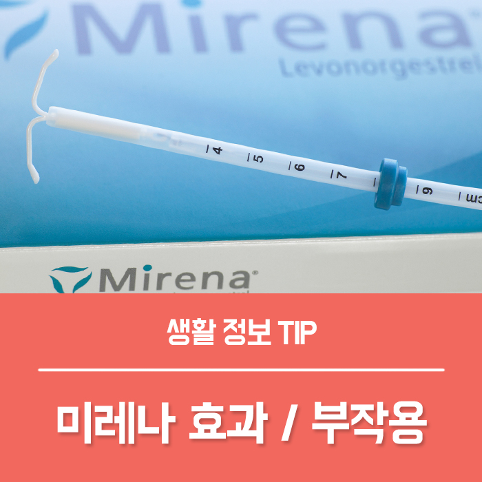  여성 피임시술 미레나 효과 부작용 체중증가 미레나 제거 총정리!