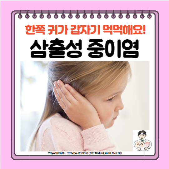  삼출성 중이염 원인 증상 치료 수술 귀 먹먹함 귀가 먹먹할 때