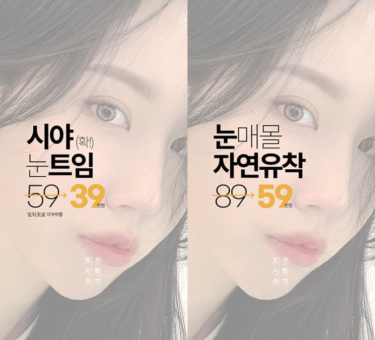 눈,코성형(이벤트)"나 지금 너무 신나, 치유에서 예뻐질 생각에!"