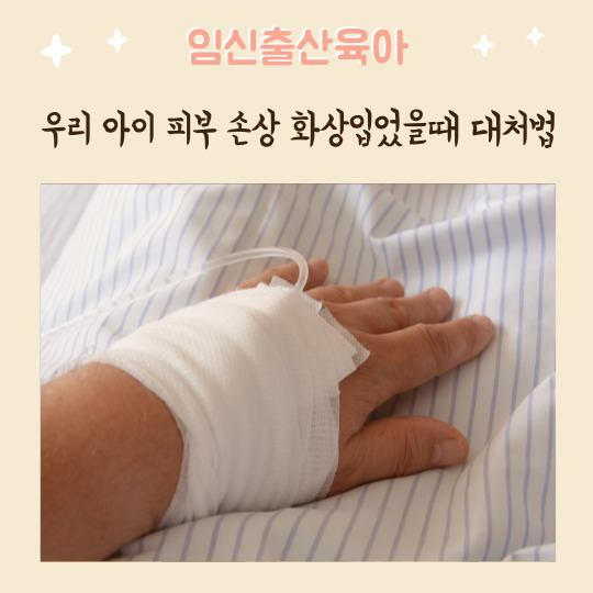  우리 아이 피부 손상 화상입었을때 대처법