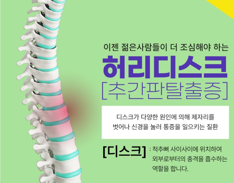[송파구의 척추] 요추5 - 척추1번 허리디스크 파열, 신경주사 치료로 완치 5
