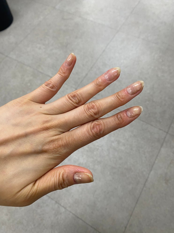  닥터 모가나 머리카락 대신 손톱이 튼튼해졌어요