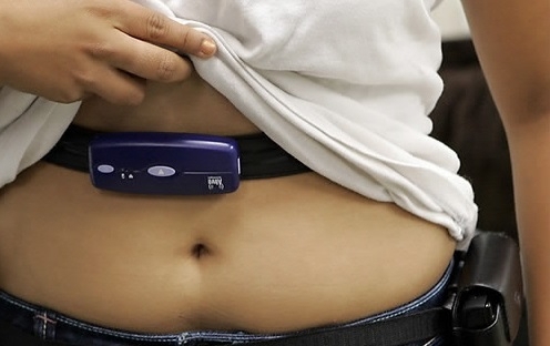 “17개월에 23kg 감량”…비만 치료제의 ‘킹콩’이 온다 “17개월에 23kg 감량”…비만 치료제의 ‘킹콩’이 온다