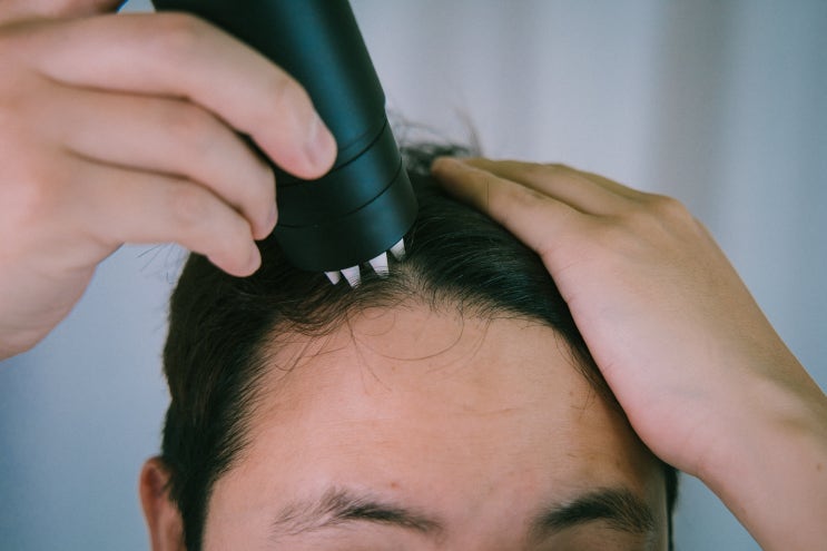  솔깃한 두피관리 방법 공유! (남자/여자 M자 탈모 헤어토닉 추천)