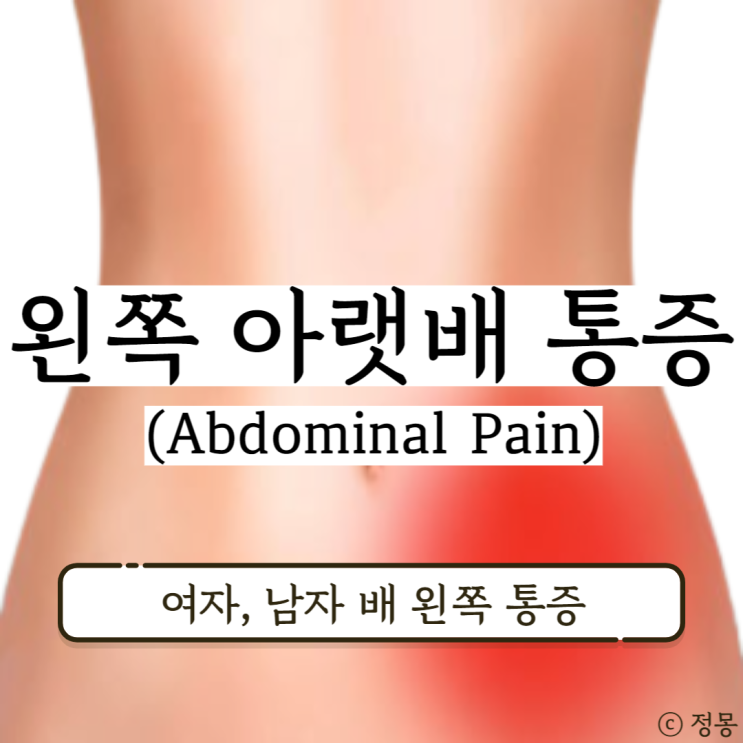 왼쪽 아랫배 통증 여자 남자 배왼쪽통증 콕콕 의심 질환 왼쪽 아랫배 통증 여자 남자 배왼쪽통증 콕콕 의심 질환