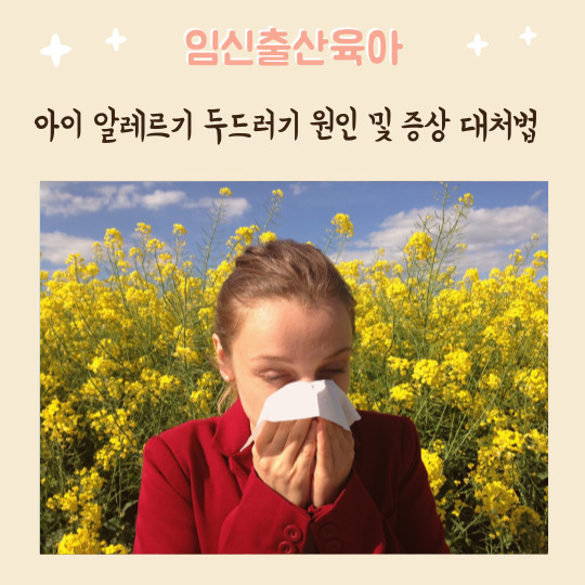  아이 알레르기 두드러기 원인 및 증상 대처법