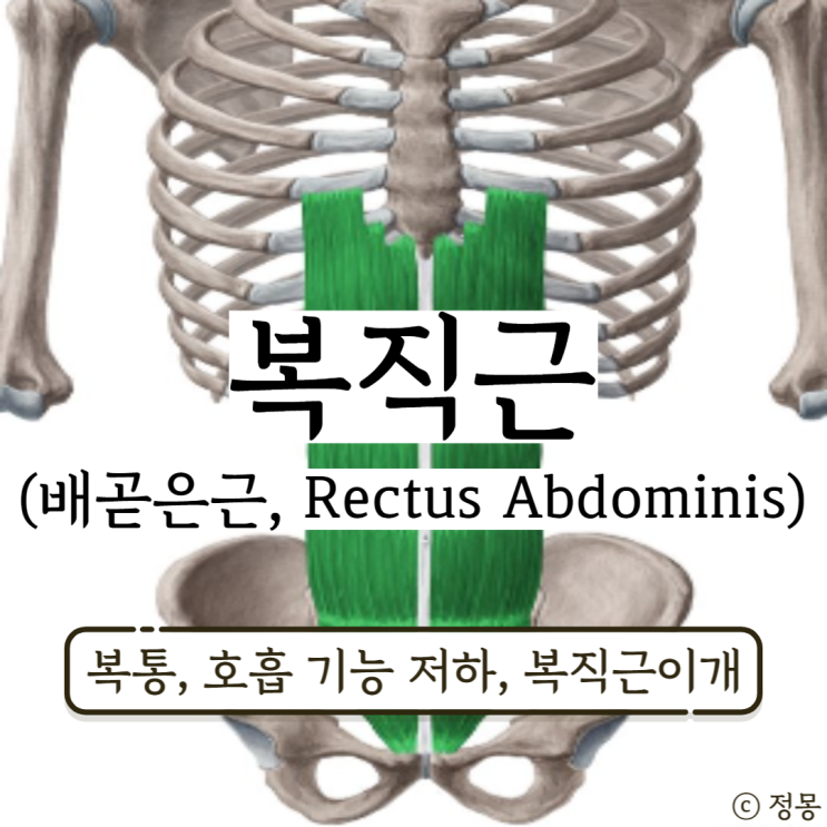 복직근 통증 복직근이개 호흡 기능 저하 예방 스트레칭 배곧은근 (Rectus Abdominis) 복직근 통증 복직근이개 호흡 기능 저하 예방 스트레칭 배곧은근 (Rectus Abdominis)
