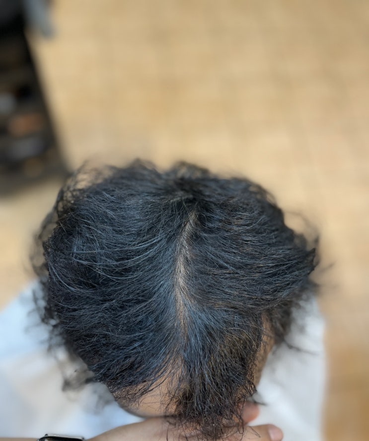  부산사상미용실르네시떼 남자m자 정수리탈모 넌 어떡할래 탈모성형펌/ 부산탈모동래탈모연산탈모김해탈모서면탈모수영탈모해운대탈모다대탈모덕천탈모안락탈모중구탈모신항탈모녹산탈모감천탈모거제탈모