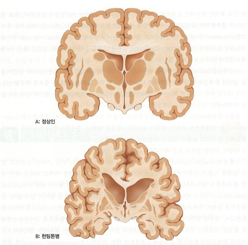 신경계 - 대뇌기저핵, 바닥핵, 기저핵, 대뇌핵, basal ganglia 정리 / 운동학습과 운동조절에 관여하는 뇌 영역 ...