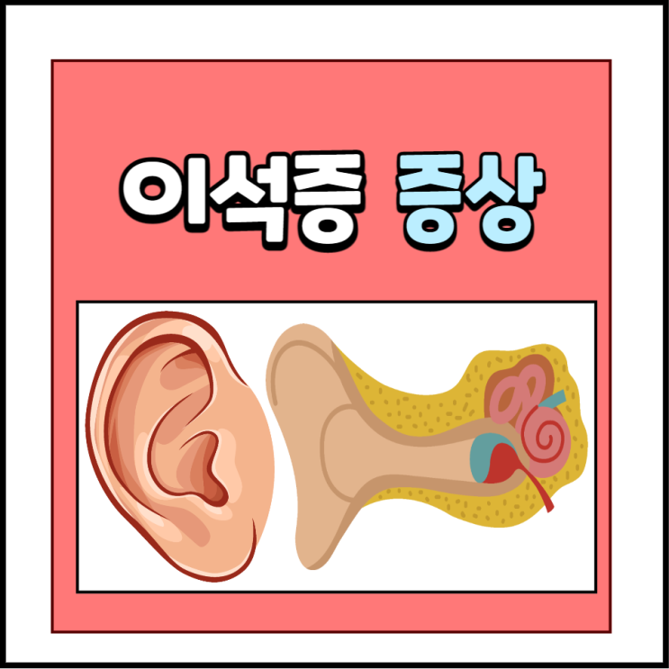 이석증 초기증상 원인 병원 검사 비용 치료법에 대해 알아봐요 이석증 초기증상 원인 병원 검사 비용 치료법에 대해 알아봐요