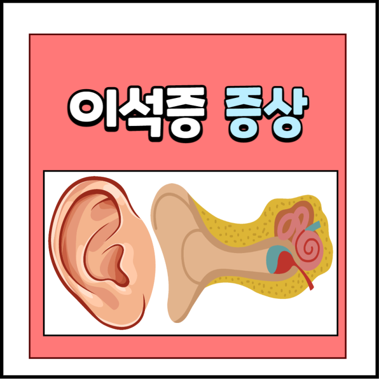 이석증 초기증상 원인 병원 검사 비용 치료법에 대해 알아봐요