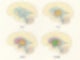 신경계 - 대뇌기저핵, 바닥핵, 기저핵, 대뇌핵, basal ganglia 정리 / 운동학습과 운동조절에 관여하는 뇌 영역 ...