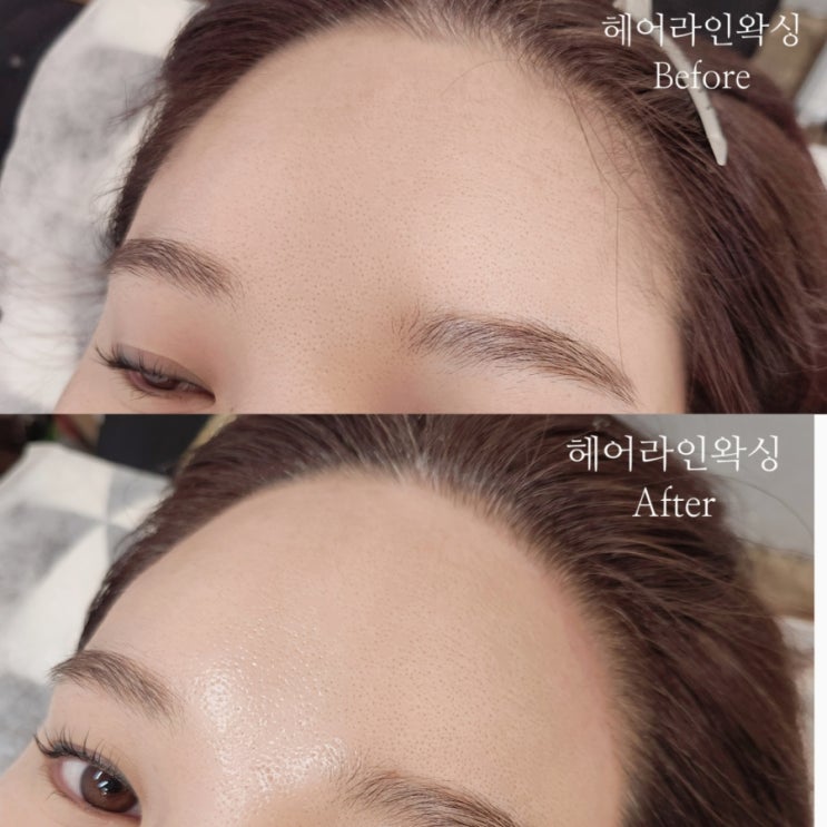  울산 북구 송정동 화봉동 자연스러운 헤어라인왁싱