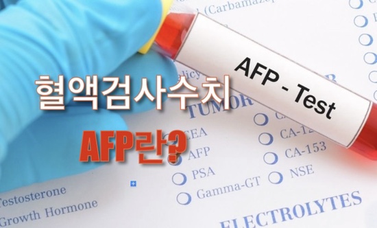간암 표지자 AFP 수치란? 추적검사중 이야기