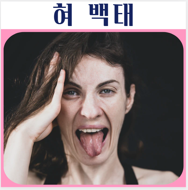 혀에 하얀색 <b>백태</b>(<b>설태</b>) 원인, <b>입냄새</b> 제거방법