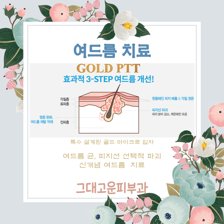 장산 여드름 치료는 골드ppt 장산 여드름 치료는 골드ppt