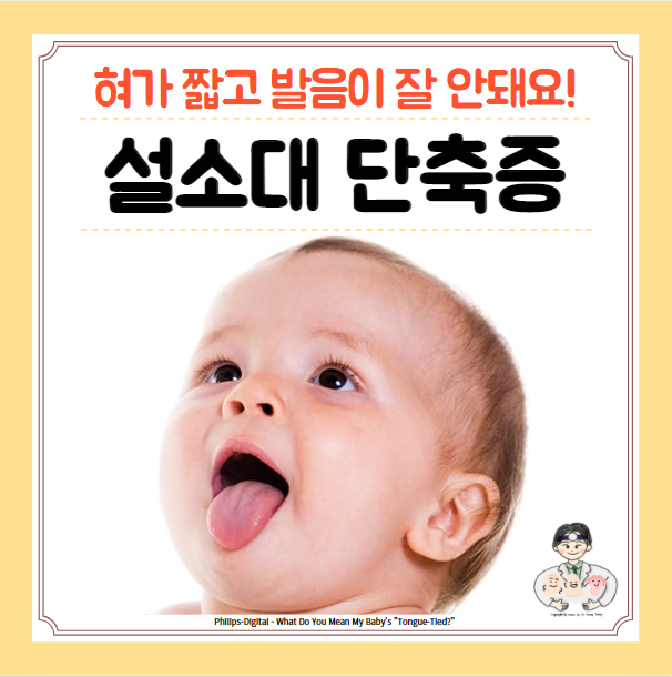  신생아 아기 성인 설소대 단축증 수술