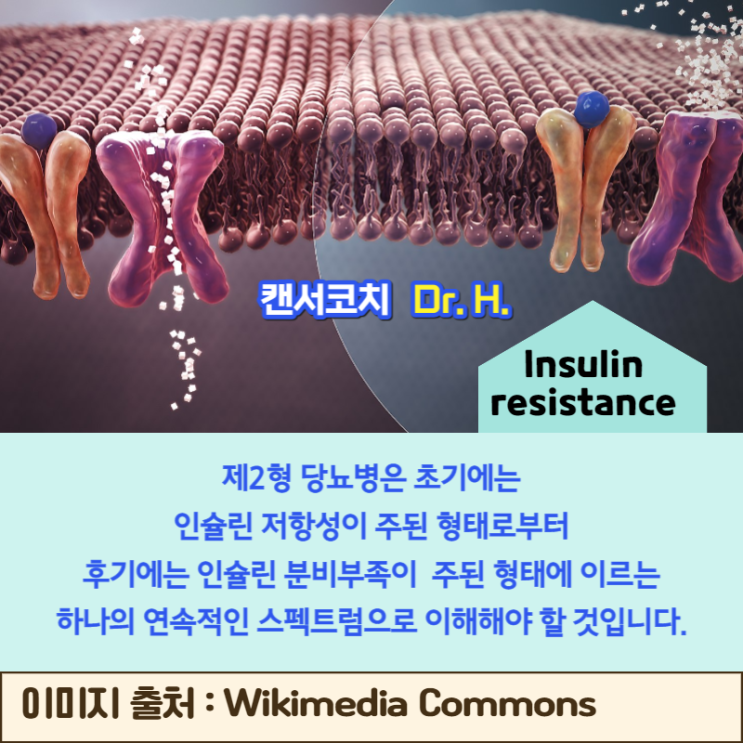  인슐린저항성 개념 및 역사 제2형 당뇨병 청혈해독 한의원 한방병원