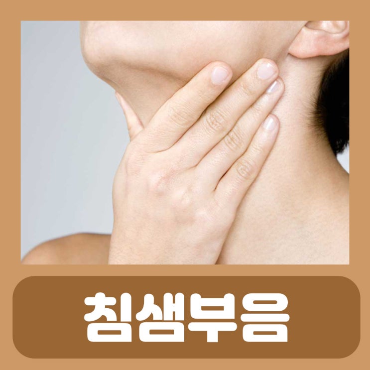 침샘 부음 침샘염 침샘암 침샘비대증 증상 : 귀뒤 목뒤 목에 멍울 턱밑 몽우리