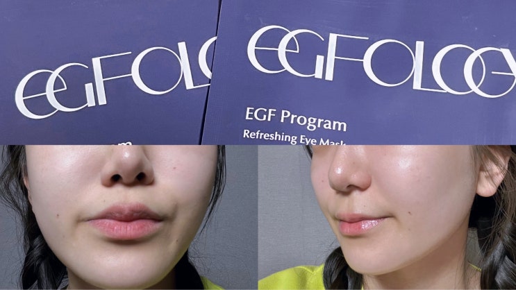 눈가 잔주름 개선 EGF 프로그램 리프레싱 아이마스크로 편하게 관리해요