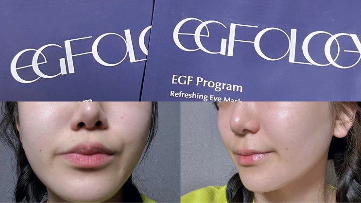  눈가 잔주름 개선 EGF 프로그램 리프레싱 아이마스크로 편하게 관리해요