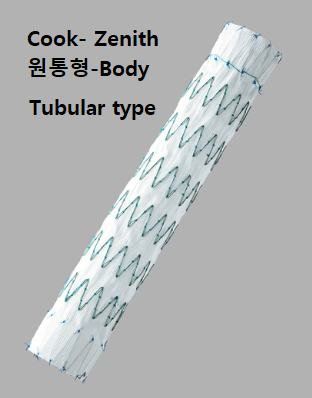 복부대동맥류(AAA, abdominal aortic aneurysm)에 대한 중재적 치료(EVAR)의 접근 : 네이버 블로그