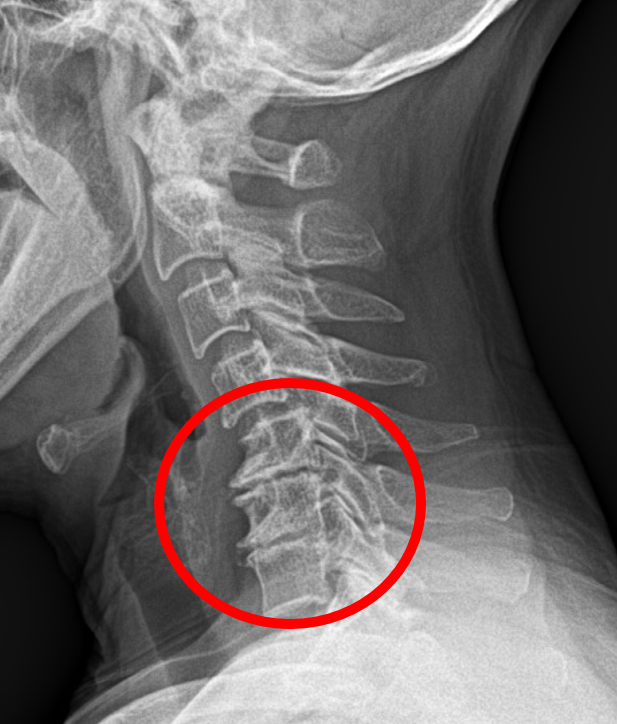 자동차 보험 치료는 언제까지 받을 수 있습니까? 치료기간 연장을 위한 진단서 발급. 5