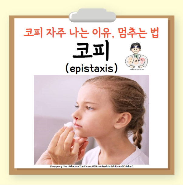 코피(epistaxis) 자주 나는 이유 원인 지혈 멈추는 법