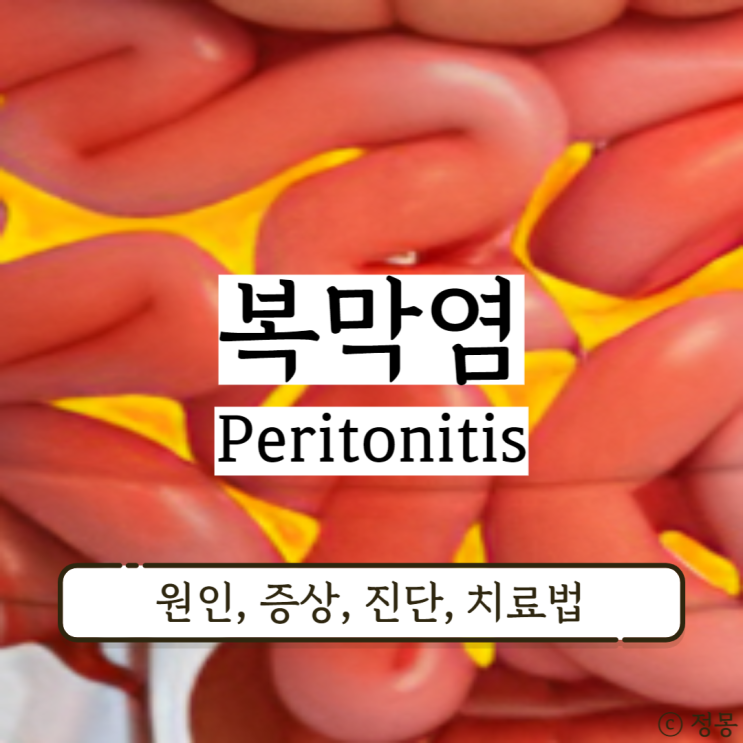 복막염원인 맹장복막염 증상 진단 및 치료법 복막염원인 맹장복막염 증상 진단 및 치료법
