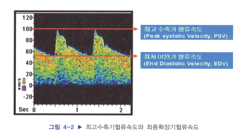 신경외과 검사: TCD 뇌혈류검사, 검사전후 간호 /결과해석 고 SAH : 네이버 블로그