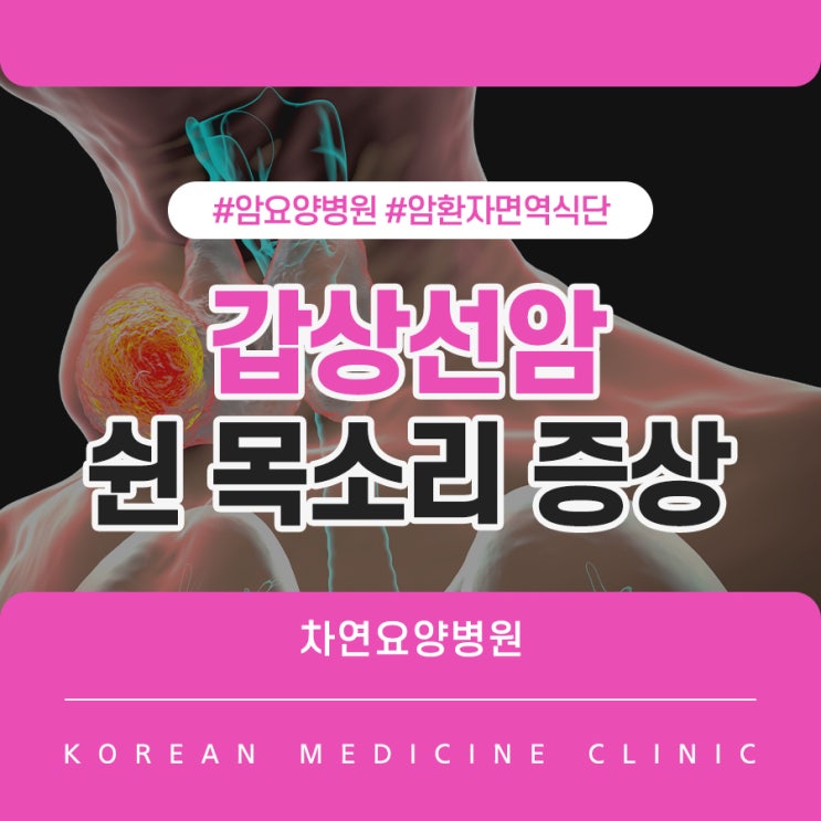  갑상선암 쉰 목소리 착한암이라고 가볍지 않아