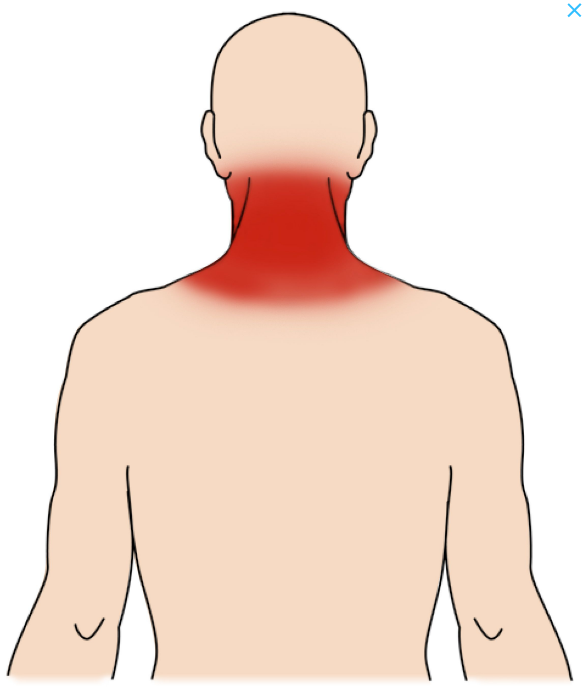  교통사고 이후 흔한 후유증 5가지는? (부전동 한의원)