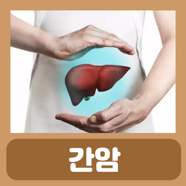  간암에좋은음식 간암 초기증상 복수 4기 증상