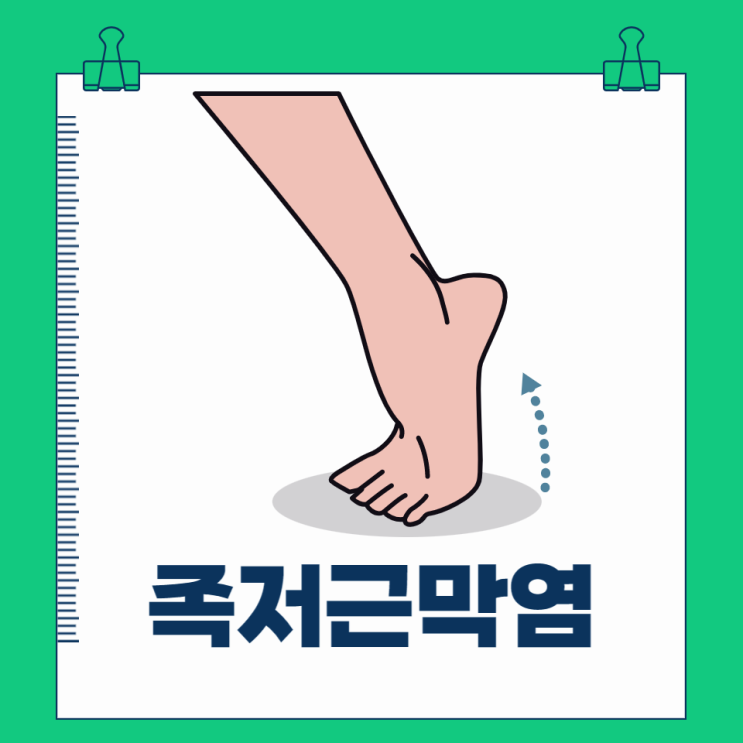 족저근막염 증상 원인 자가치료 치료방법 스트레칭