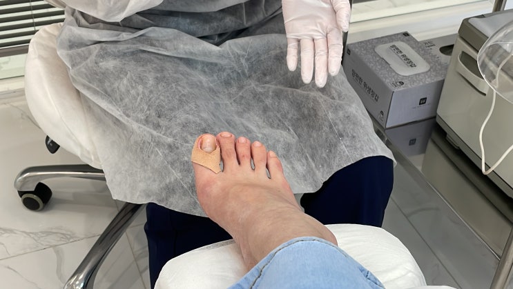 부산발관리 발톱관리는 레푸스 부산사직점에서