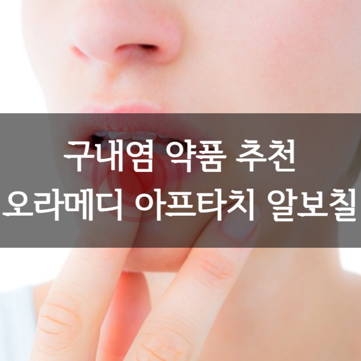  구내염원인 증상 치료 ㅣ구내염 빨리 낫는 방법 아프타치 알보칠
