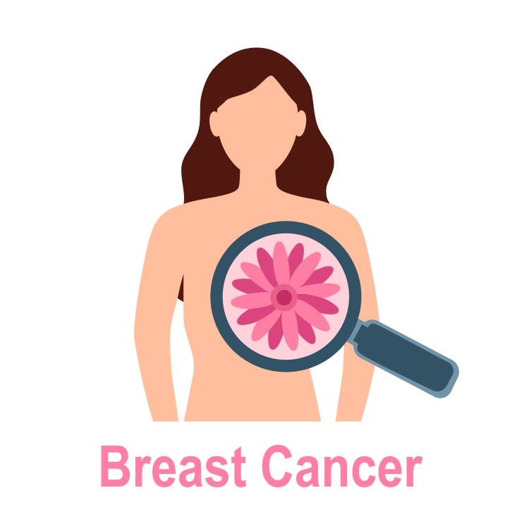  유방암 예방법_국가암정보센터(cancer.go.kr)