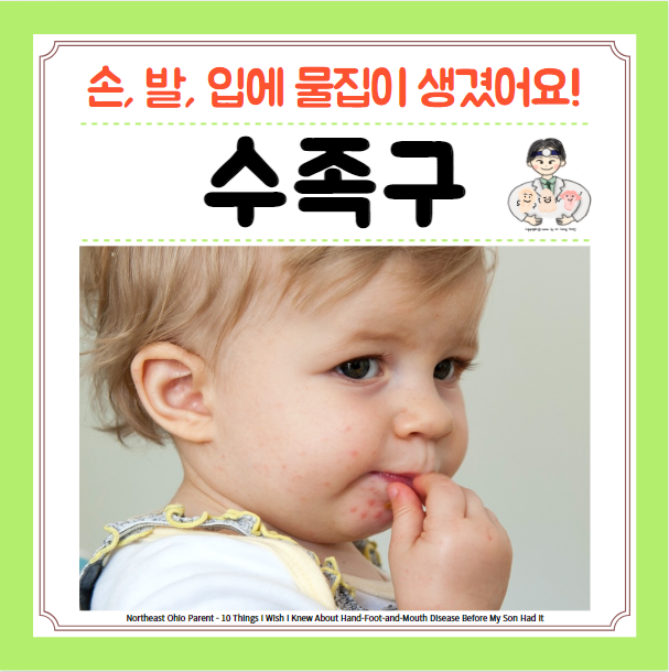  아기 영유아 수족구 수족구병 잠복기 원인 증상 전염 치료 격리