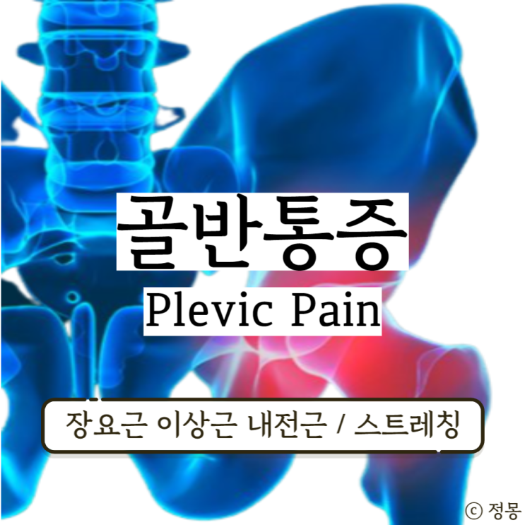 오른쪽 골반 통증 근육 장요근 이상근 내전근 스트레칭 오른쪽 골반 통증 근육 장요근 이상근 내전근 스트레칭