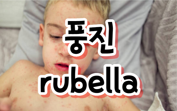 풍진(rubella): 임산부와 일반인을 위한 증상, 위험성, 예방 방법 그리고 백신 접종 중요성(가격 포함)