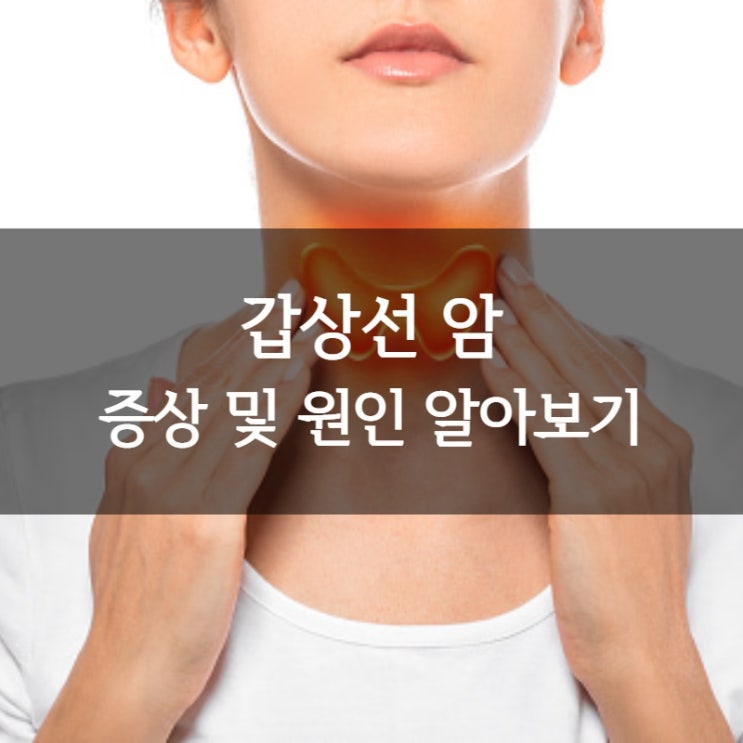  갑상선암증상 및 원인 ㅣ 요오드 에스트로겐 갑상선암 수술 후 관리방법