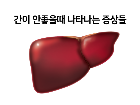  간이 안좋을때 나타나는 증상들