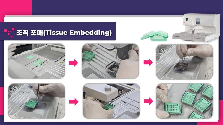  조직 샘플 포매하는 방법(Embedding)