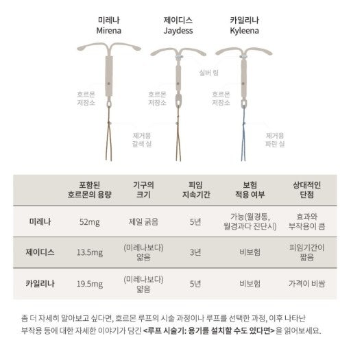 미레나 재시술 후기