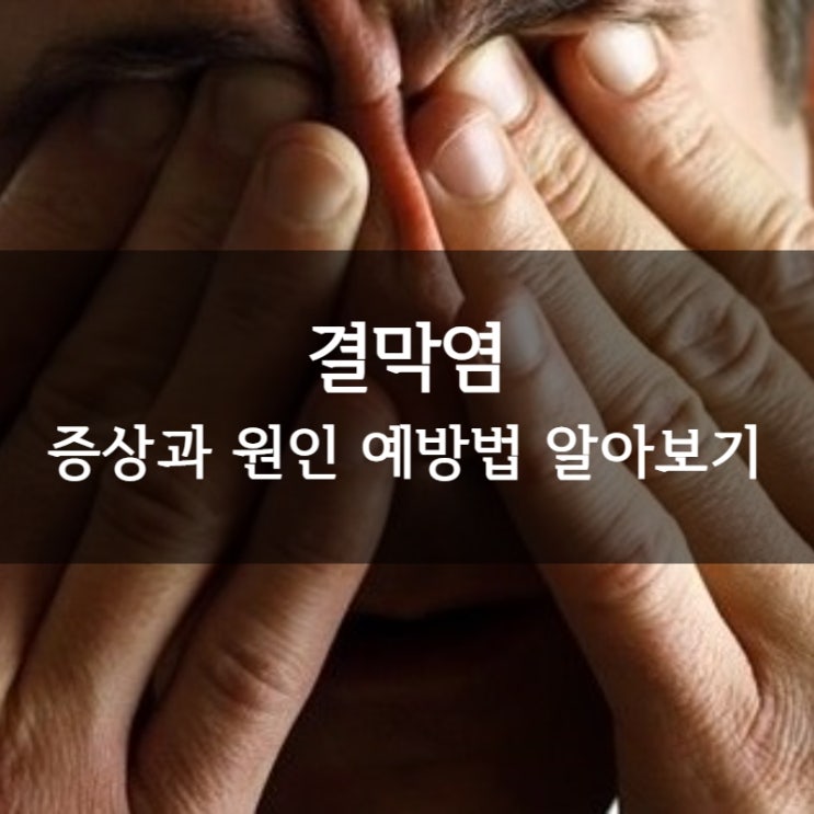  결막염증상과 원인 ㅣ 결막염 예방법 알아보기