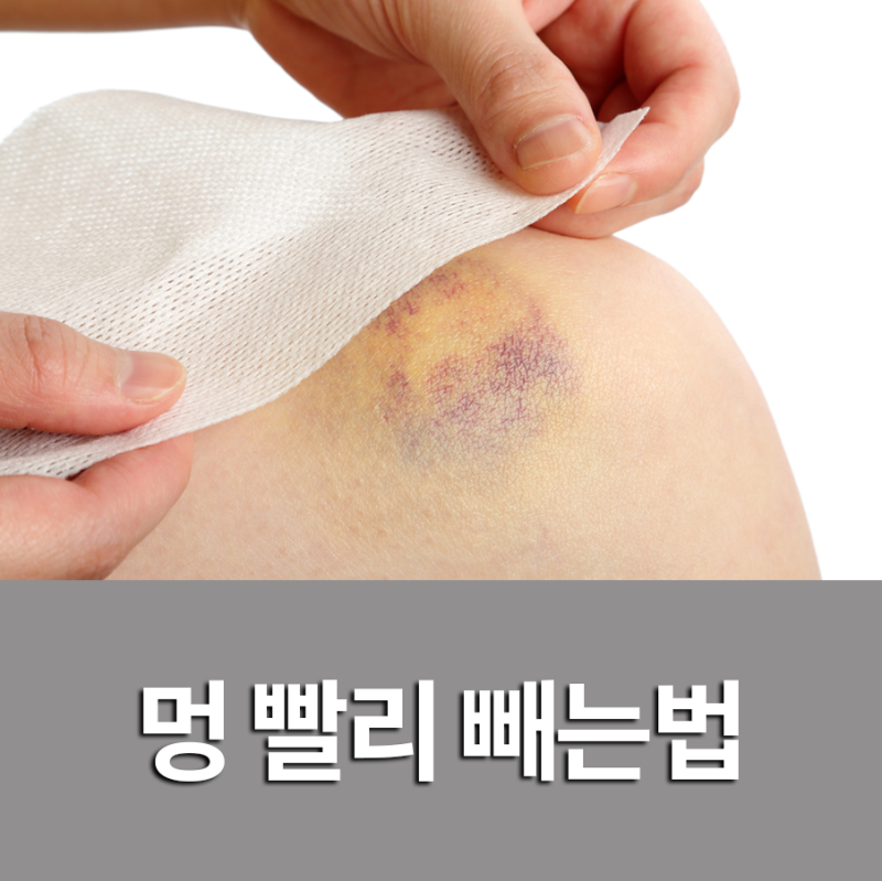 멍을 빨리 없애는 효과적인 방법 1가지