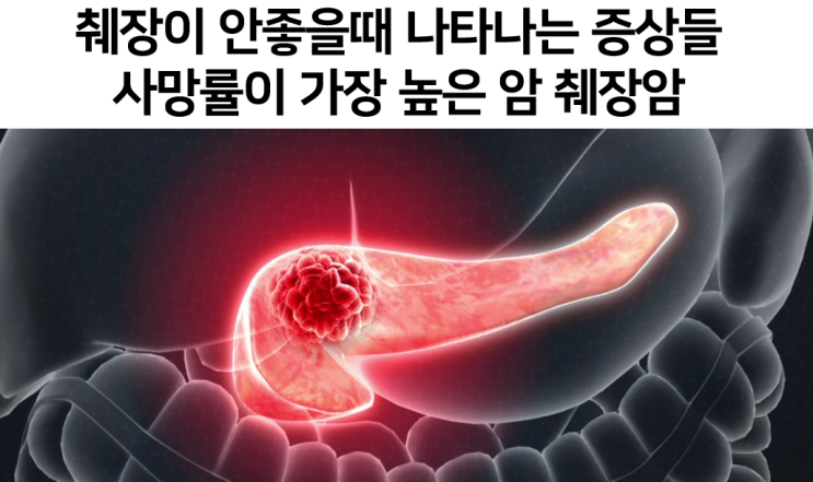  췌장이 안좋을때의 증상과 예후