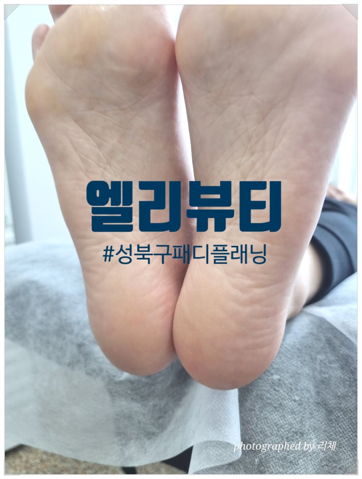  성신여대 피부관리 손빠른 패디플래닝은 엘리뷰티에서(발뒤꿈치각질부자 전후샷)