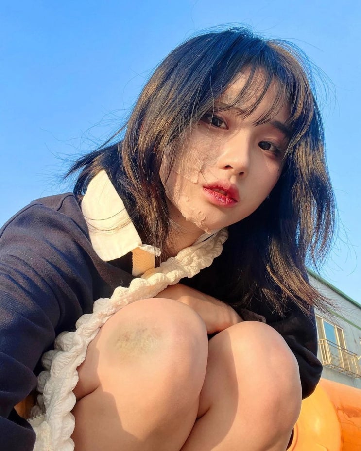 '50만 유튜버' 노은솔, 교통사고 당한 후 뇌진탕에 얼굴 상처까지...심각한 사고 당했다 '50만 유튜버' 노은솔, 교통사고 당한 후 뇌진탕에 얼굴 상처까지...심각한 사고 당했다